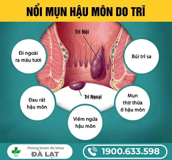 Hình ảnh minh họa